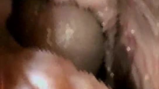 Knob inside virgin vagina